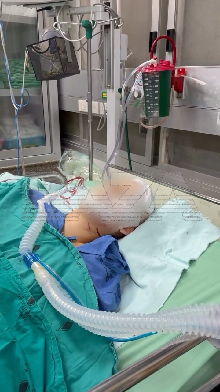 В Таиланде российская модель впала в кому после аварии на байке В Таиланде российская модель впала в кому после аварии на байке